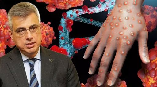 Bakan Memişoğlu: Maymun çiçeği için ekstra bir tedbire ihtiyaç yok